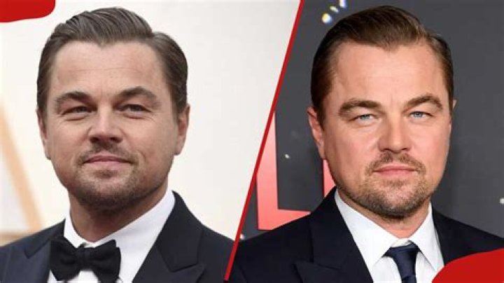 25 Celebrities Born With Cleft Lips ViraLuck