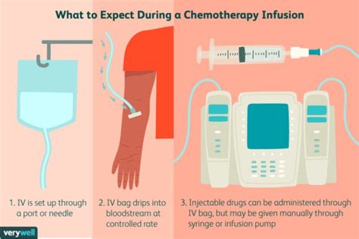 5 Ways To Chemotherapy Infusion Coding Cheat Sheet 20 vrogue.co