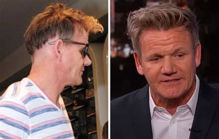Gordon Ramsay sparks new hair transplant rumours with questionable hairstyle Daily Mail Online