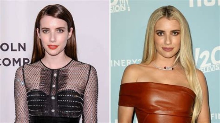 Has Emma Roberts Had Plastic Surgery? BeforeAndAfter Photos Life