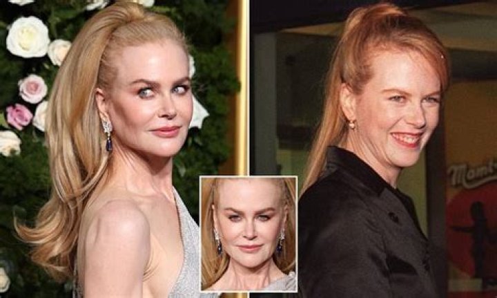 Has Nicole Kidman Had Plastic Surgery? The Actress's Face Has Been