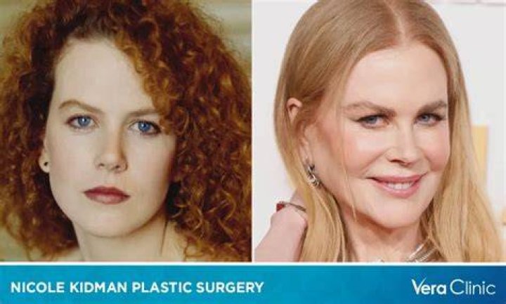 Is it Plastic Surgery? Nicole Kidman&rsquo;s Looks Over the Years