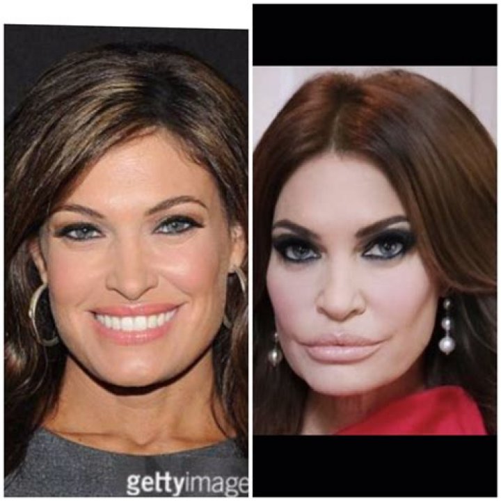 Kimberly Guilfoyle&rsquo;s Before Plastic Surgery Pictures Uncovered