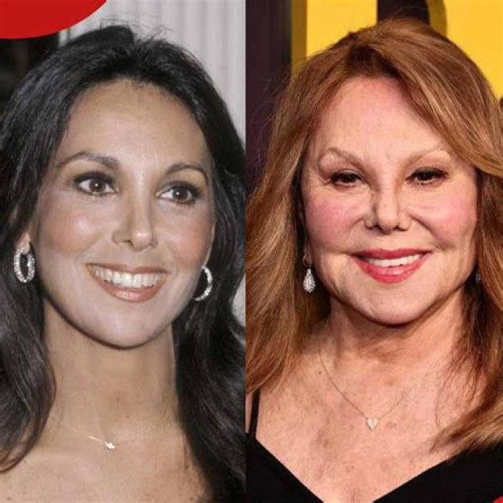 Marlo Thomas Plastic Surgery Before And After Nose Job Pictures Revealed!