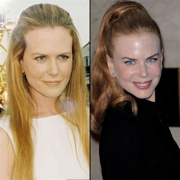 Nicole Kidman at 44 How Her Face Has Changed Us Weekly