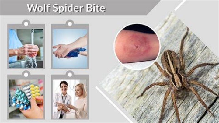 Wolf Spider Bite Symptoms, Treatment, and Pictures.